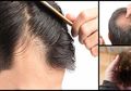 4 Kondisi Rambut Ini Dapat Ungkap Kesehatan Anda, Yuk Cek Sekarang!