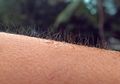 Ini Arti Kesehatan Dibalik Lebatnya Bulu di Setiap Bagian Tubuh Wanita