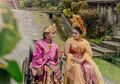 Manusia dengan Penyakit Langka ini Akhirnya Persunting Sang Kekasih dengan Dihadiri Pejabat Bali dan 1.000 Undangan