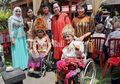 Pria Pengidap Penyakit Langka ini Akhirnya Nikahi Gadis Impiannya Setelah 6 Tahun Pacaran