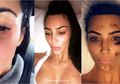 Kim Kardashian Ternyata Penderita Psoriasis di Wajah! Skin Tightening Solusinya Supaya Bisa Tampil Sempurna
