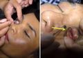 Ngeri, Klinik Ini Menawarkan Layanan Cuci Mata yang Katanya Bisa Memperjelas Penglihatan