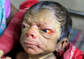 Terkena Sindrom Aneh, Bayi Ini Mempunyai Wajah Seperti Kakek-kakek Usia 80 Tahun!