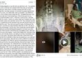 Akibat Teledor Menggunakan KB Spiral, Wanita Usia 25 Tahun Ini Mengalami Nasib Mengenaskan, Indung Telur Diangkat Organ Tubuhnya tak Berfungsi