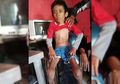 Penyebab TBC yang Renggut Nyawa Fajar Saefudin, Bocah 10 Tahun dengan Tubuh Kering Kerontang Asal Cianjur