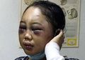 Dipukuli Pakai Palu hingga Disuruh Tidur dengan Anjing, Ini Kisah Kekerasan terhadap TKW di Malaysia, Singapura, dan Hong Kong