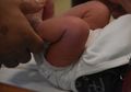 Bayi 5 Bulan Meninggal Usai Disunat oleh Orangtuanya Sendiri di Rumah