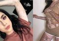 Dibully Karena Alami Vitiligo, Wanita Ini Ubah Tubuhnya Menjadi Karya Seni Unik