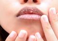 Bibir Kering dan Pecah-pecah? Coba 7 Cara dengan Obat Rumahan Berikut Ini!