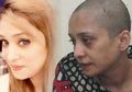 Tolak Perintah Suami untuk Menari di Depan Teman-temannya, Wanita Ini Disiksa dan Digunduli