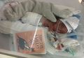 Diperkirakan akan Meninggal, Bayi Seukuran Telapak Tangan ini Berhasil Lewati Masa Kritis, Lihat Kondisinya Sekarang!