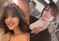 Diduga Suntik Filler, Intip Bibir Tebal Seksi Alami Gisella Anastasia VS Agnez Mo