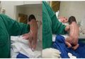 Bikin Kaget Dokter, Bayi yang Baru Saja Lahir Ini Tiba-tiba Berusaha untuk Berjalan