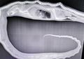 Melalui Sinar X-Ray Makan Terakhir Ular Piton Inilah yang Membuatnya Tidak Berdaya Hingga Mati