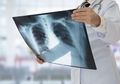 Mengira 'Hanya' Alami Flu, Pria Ini Justru Berakhir dengan Kondisi Tak Bisa Makan dan Bicara