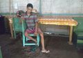 Kondisi Ekonomi Sulit, Pria Ini Hanya Minum Obat Batuk untuk Asma yang Ia Derita dari Lahir