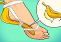 Ingin Obati Mata Ikan di Kaki? Cukup Beri Kulit Pisang Selama 3 Hari dan Dapatkan Hasil Menakjubkan