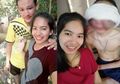Tak Memandang Kondisi Fisik, Wanita Ini Tetap Cintai Kekasihnya yang Wajahnya Berubah Mengerikan Akibat Terkena Kanker Mata!