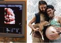 Awalnya Tak Percaya Kekasihnya Hamil, Setelah Tes USG Ternyata Ada Bayi Lelaki di Perut Pria Ini!