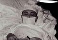 Dokter Ini Operasi Dirinya Sendiri Karena Tak Ada yang Bisa Membantunya: 'Itu Operasi Biasa'