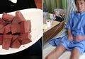 Akibat Makan Darah Babi, Pria Ini Menderita Infeksi Mematikan dan Kedua Kakinya Diamputasi