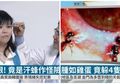 Ngeri, Dokter Menemukan 4 Lebah Hidup di Mata Perempuan Ini dan Meminum Air Matanya