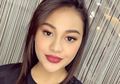 Dirawat karena Sering Mimisan, Aurel Sampai Teriak Saat Alat Medis Masuk ke Hidungnya: Mau Pingsan!