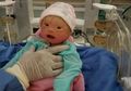 Seorang Bayi Idap Penyakit Mengerikan, Bisa Meninggal Dunia Hanya Karena Disentuh