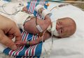 Walau Berat Badannya Hanya 310 Gram, Bayi Mungil Ini Dapat Bertahan Hidup dan Pulang dari NICU