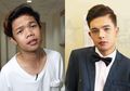 Sempat Viral Karena Operasi Plastiknya, Wajah 'Babang Tamvan' di Filipina Ini Dikabarkan Kembali ke Bentuk Aslinya