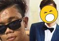 Jadi Ganteng Sehabis Oplas, Wajah Mantan Anggota Boyband Ini Dikabarkan Kembali Ke Wajah Aslinya