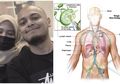 2 Sejoli Ini Gagal Nikah Karena Keduanya Mengidap Kanker Getah Bening, Inilah Kisah Dibalik Cerita Viral Mereka Berdua