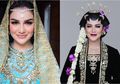 Mirip Banget! Cantiknya Makeup Pengantin Irish Bella dan Kahiyang Ayu dalam Riasan Overdrawn Lips dengan Busana Tradisional