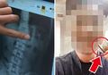 Pria ini Kaget ketika Perutnya Mengeluarkan Bunyi Aneh, Hasil Rontgen Ternyata Sangat Mengejutkan!