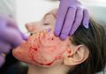 Lakukan Facial 'Vampir' Ala Kim Kardashian untuk Tampil Cantik, Dua Orang Wanita Justru Terkena HIV