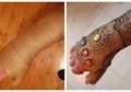 Tangannya Patah, Cowok Ini Sulap Kain Perban di Tangan jadi Infinity Gauntlet
