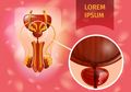 Suplemen Vitamin D Bisa Memperlambat Kanker Prostat, Begini Faktanya