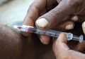 Duh, 90 Orang Terinfeksi HIV Setelah Seorang Dokter Gunakan Jarum Terkontaminasi, 65 Korbannya adalah Anak-anak