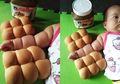 Foto Bayi Dengan Lengan Seperti Roti Sobek Jadi Viral, Begini Penjelasan Medisnya