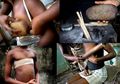 Ngeri, Payudara para Wanita di Negara Ini Disetrika, Demi Menekan Angka Kejahatan Seksual