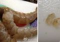 Ditemukan Udang yang Disuntik dengan Gel Berbahaya di China untuk Menghasilkan Keuntungan yang Besar
