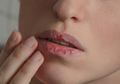Bibir Kering dan Pecah-pecah Selama Puasa, Coba Lakukan l Ini Agar Tetap Lembap #DiRumahAjaBisaCantik