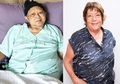 Wanita 69 Tahun Ini Juga Idap Leukimia Seperti Ani Yudhoyono, Tapi Sembuh Hanya dengan Makan Kunyit!