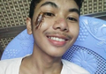 Viral Tantangan Taruh Kecoak Hidup di Muka, Ini Bahaya yang Mengintai