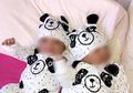 Kisah Pilu! Bayi Kembar Baru Lahir Ini Idap Kanker, Sang Ibu: 'Ku Ingin Bertukar Tempat dalam Sekejap'