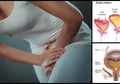 Inkontinensia Urin, Ini 4 Mitos dan Tips Mengatasi Masalah Kandung Kemih