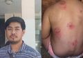 Dengan Tangan dan Mulut Membiru, Bayi 3 Bulan Tewas di Tempat Penitipan Anak