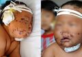 Gigit Puting Ibunya Saat Menyusu, Bayi 8 Bulan Dijahit Ratusan karena Ditusuk 90 Kali Pakai Gunting