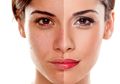 DIY Masker Tomat Untuk Atasi Masalah Flek Hitam Pada Wajah, Nggak Bikin Kantong Bolong!