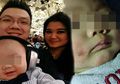Viral! Bayinya Luka di Pipi Sampai Menderita Berhari-hari, Seorang Ayah Menyesal Ajak Putranya ke Kondangan